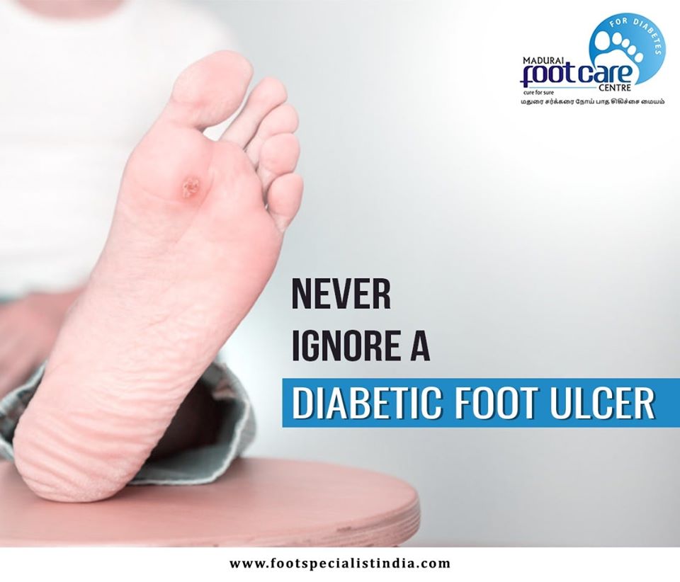 What are the causes,symptoms and treatment for Diabetic Foot Ulcer?